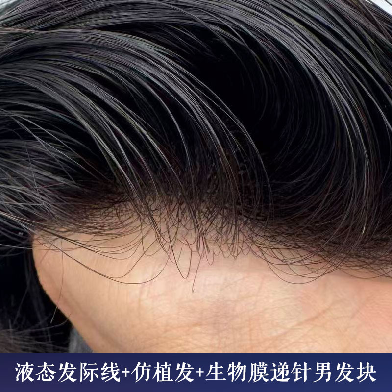 【N29#】液态发际线仿植发生物膜递针男发块
